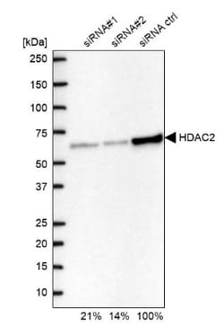 Histone Deacetylase 2/HDAC2 Antibody, Novus Biologicals 0.1mL; Unlabeled:Antibodies,
